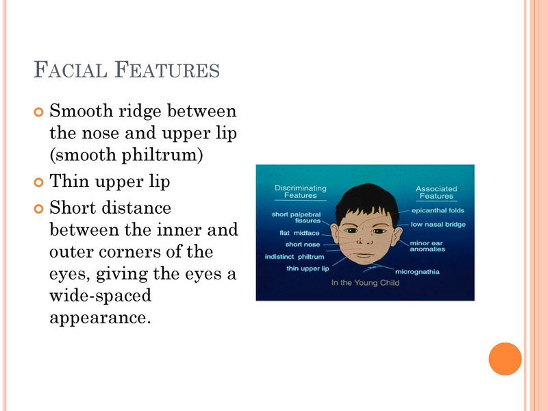 File:Fetal Alcohol Syndrome.pdf