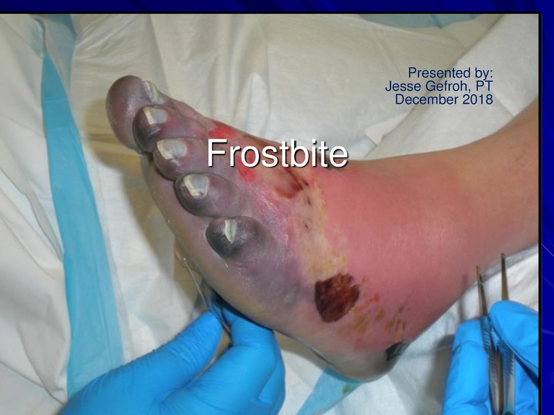 File:Frostbite-Presentation.pdf