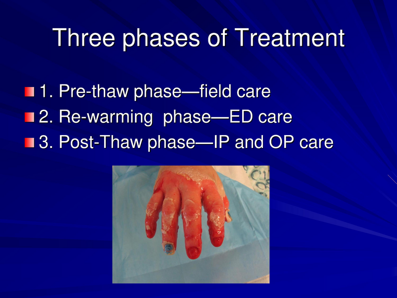 File:Frostbite-Presentation.pdf