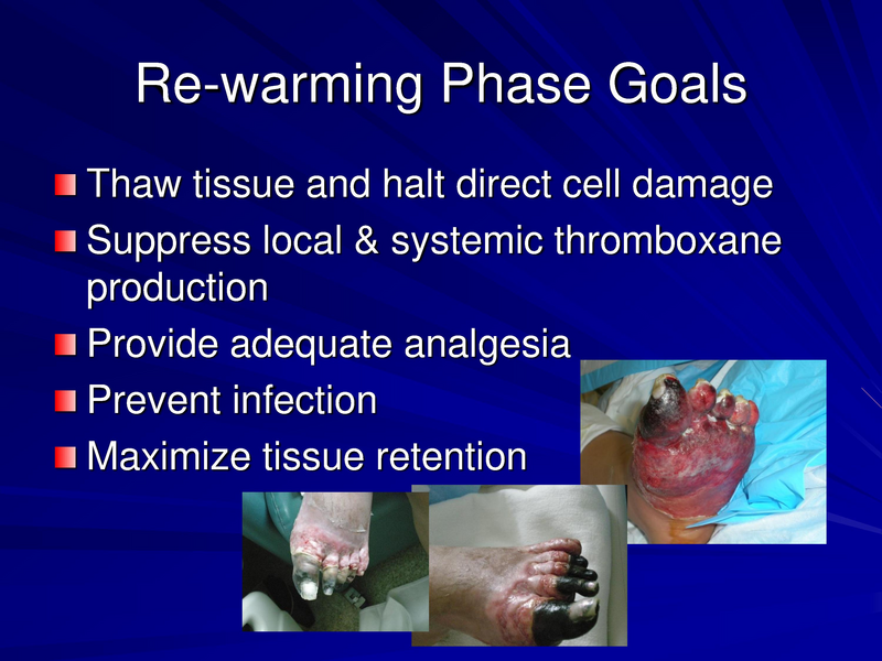File:Frostbite-Presentation.pdf