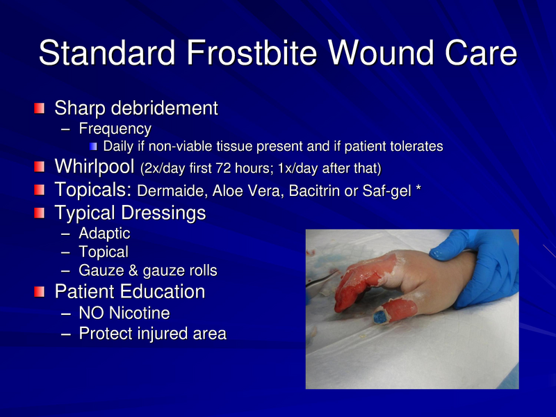 File:Frostbite-Presentation.pdf