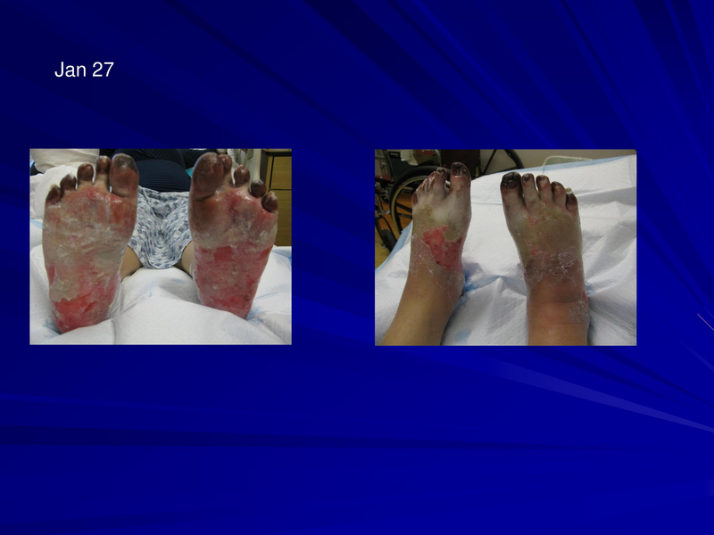 File:Frostbite-Presentation.pdf