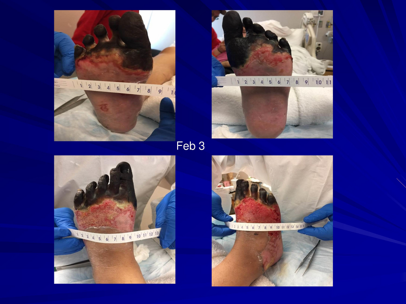 File:Frostbite-Presentation.pdf