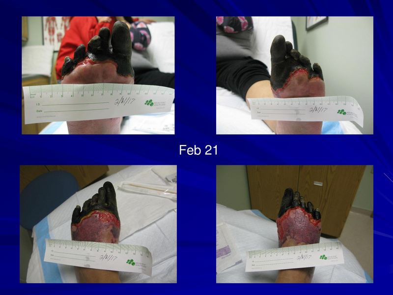 File:Frostbite-Presentation.pdf
