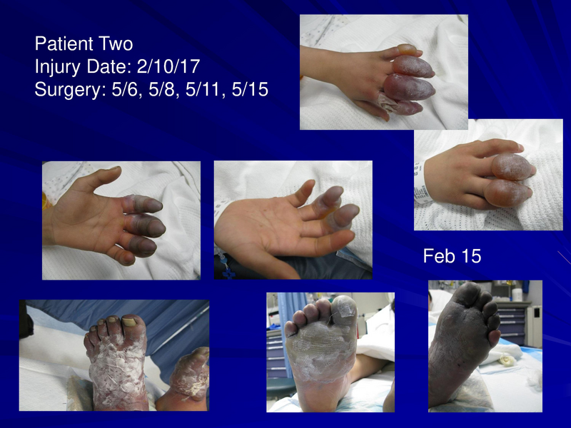 File:Frostbite-Presentation.pdf