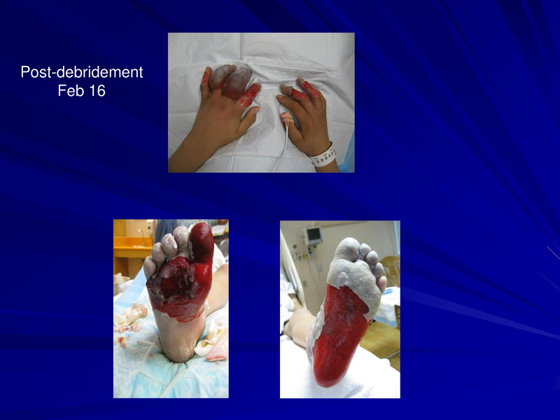 File:Frostbite-Presentation.pdf