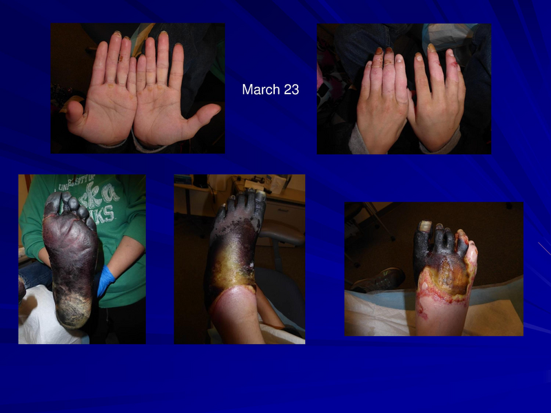 File:Frostbite-Presentation.pdf