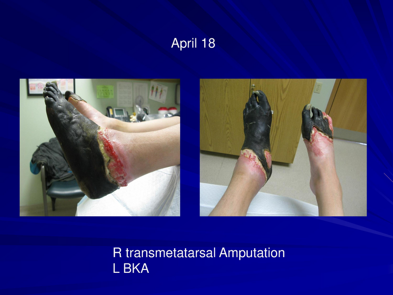 File:Frostbite-Presentation.pdf