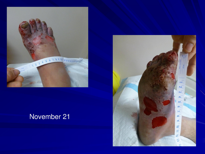 File:Frostbite-Presentation.pdf