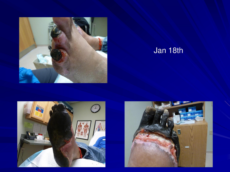 File:Frostbite-Presentation.pdf