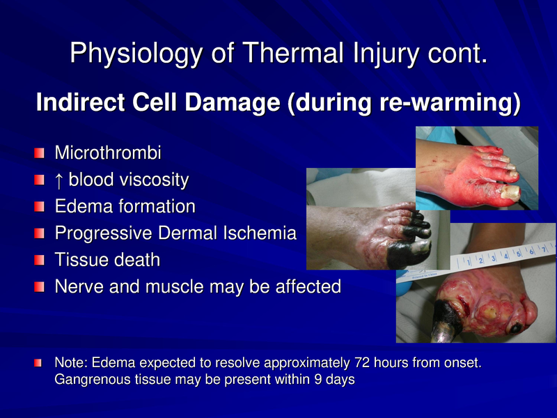 File:Frostbite-Presentation.pdf
