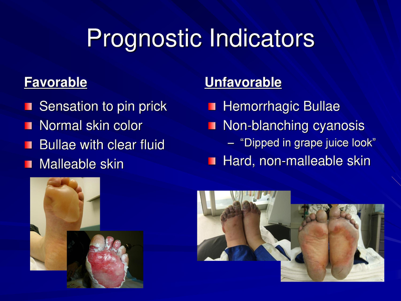 File:Frostbite-Presentation.pdf