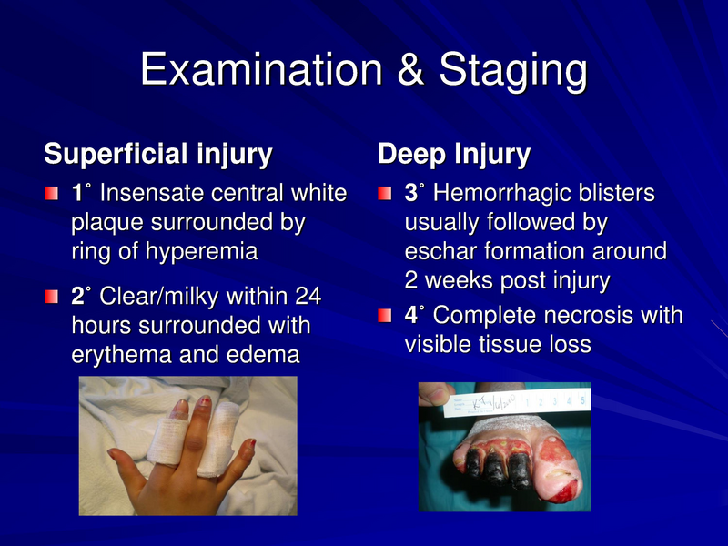 File:Frostbite-Presentation.pdf