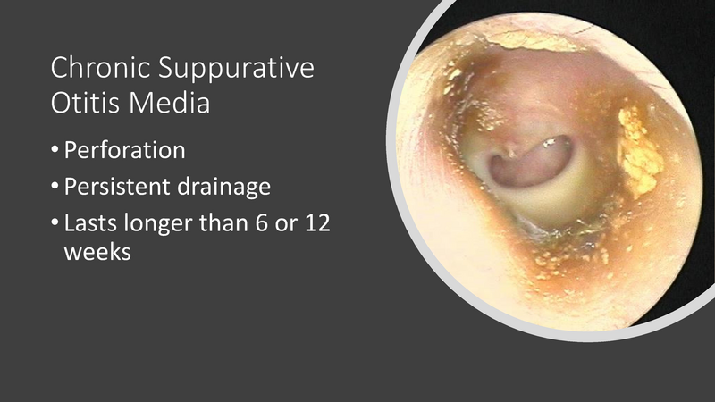 File:Otitis Media -8-13-19.pdf