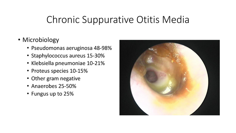 File:Otitis Media -8-13-19.pdf