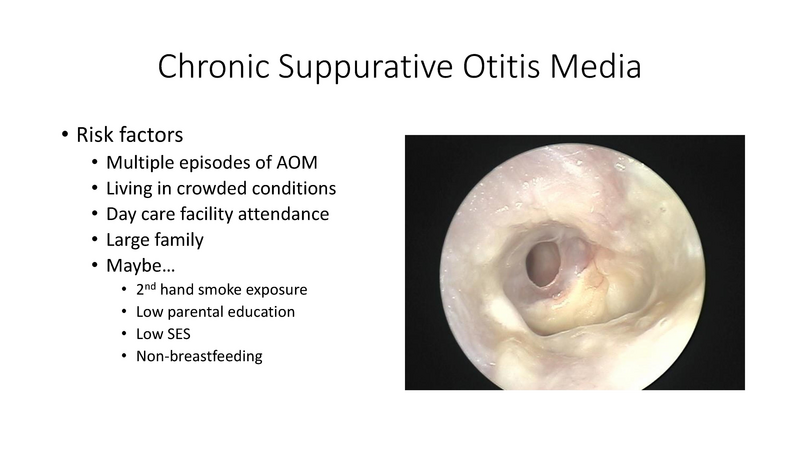 File:Otitis Media -8-13-19.pdf