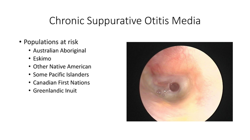 File:Otitis Media -8-13-19.pdf