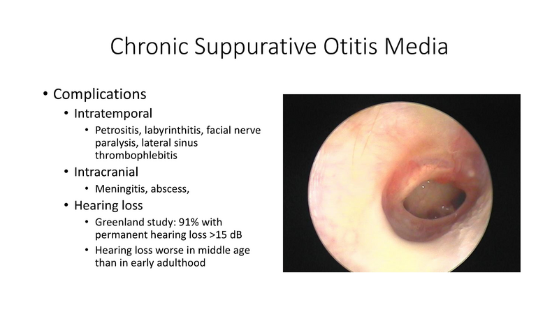 File:Otitis Media -8-13-19.pdf