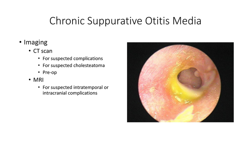 File:Otitis Media -8-13-19.pdf
