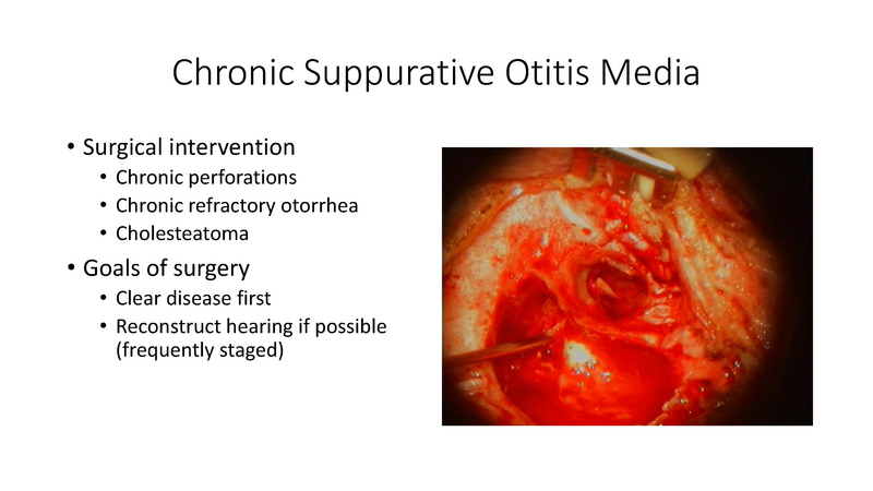 File:Otitis Media -8-13-19.pdf