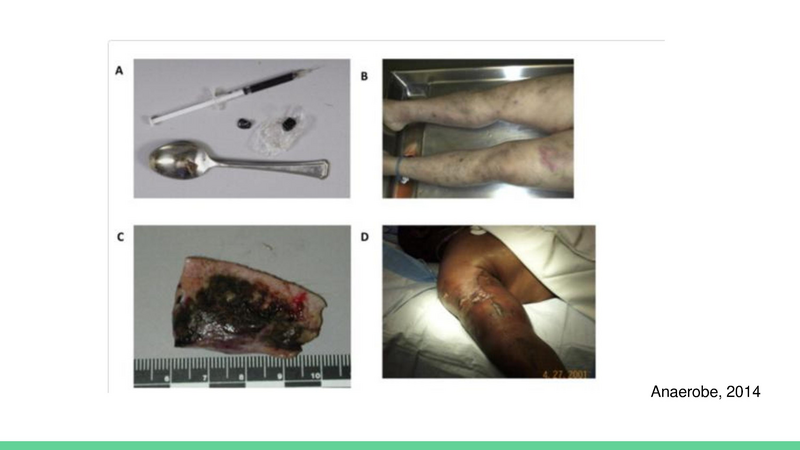 File:Wound Botulism.pdf