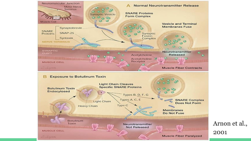 File:Wound Botulism.pdf