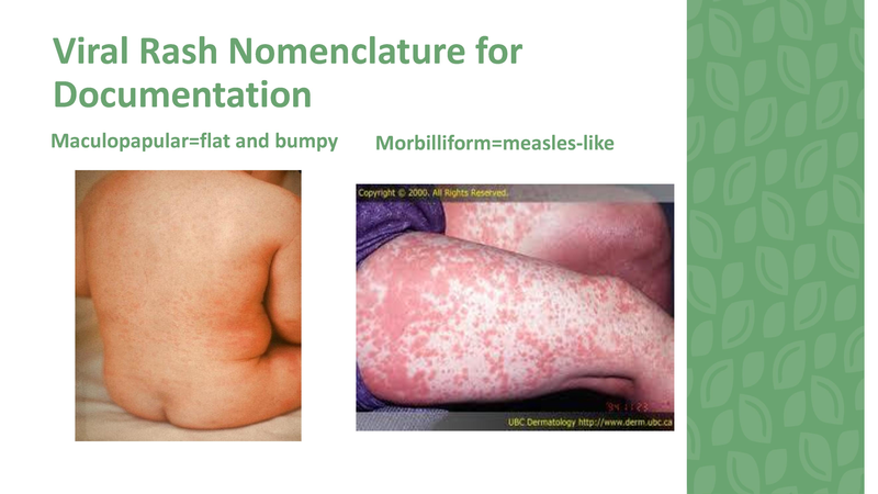 File:Stamping Out Amoxicillin Allergies - 8-6-2019.pdf