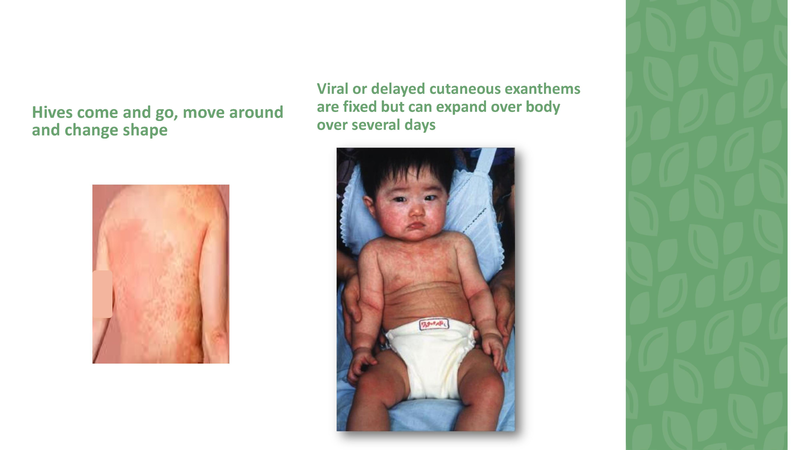 File:Stamping Out Amoxicillin Allergies - 8-6-2019.pdf