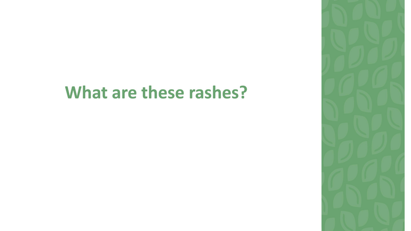 File:Stamping Out Amoxicillin Allergies - 8-6-2019.pdf
