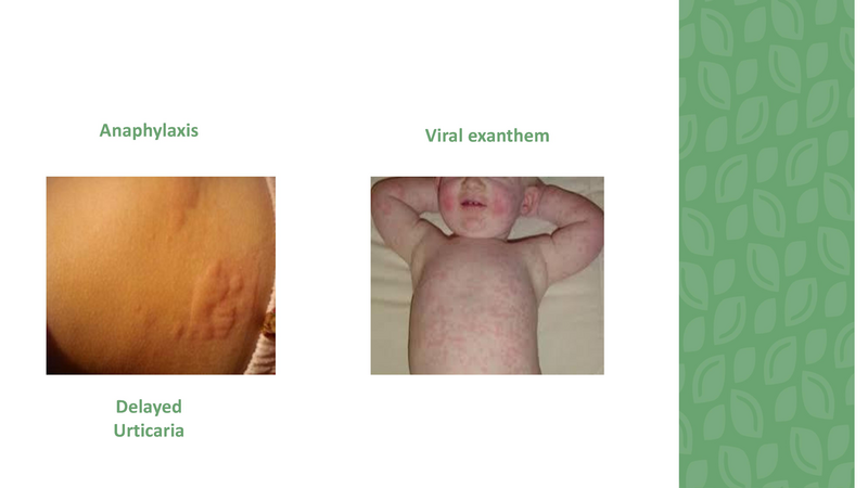 File:Stamping Out Amoxicillin Allergies - 8-6-2019.pdf