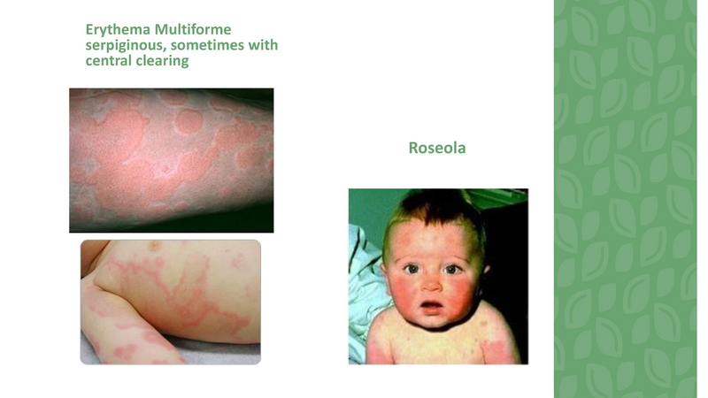 File:Stamping Out Amoxicillin Allergies - 8-6-2019.pdf