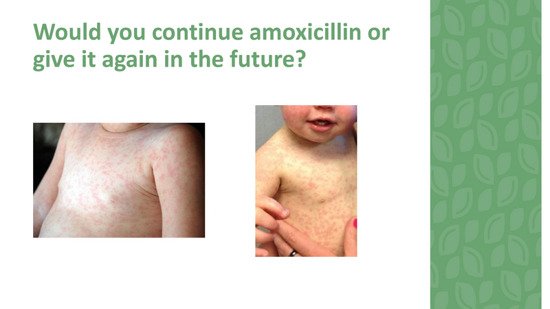 File:Stamping Out Amoxicillin Allergies - 8-6-2019.pdf