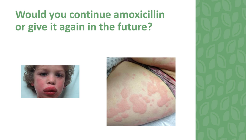 File:Stamping Out Amoxicillin Allergies - 8-6-2019.pdf