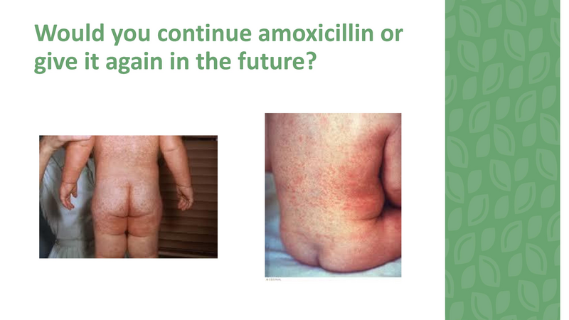 File:Stamping Out Amoxicillin Allergies - 8-6-2019.pdf