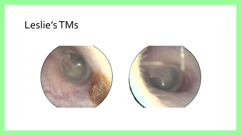 File:Pediatric RMT Pearls 9-11-2018.pdf